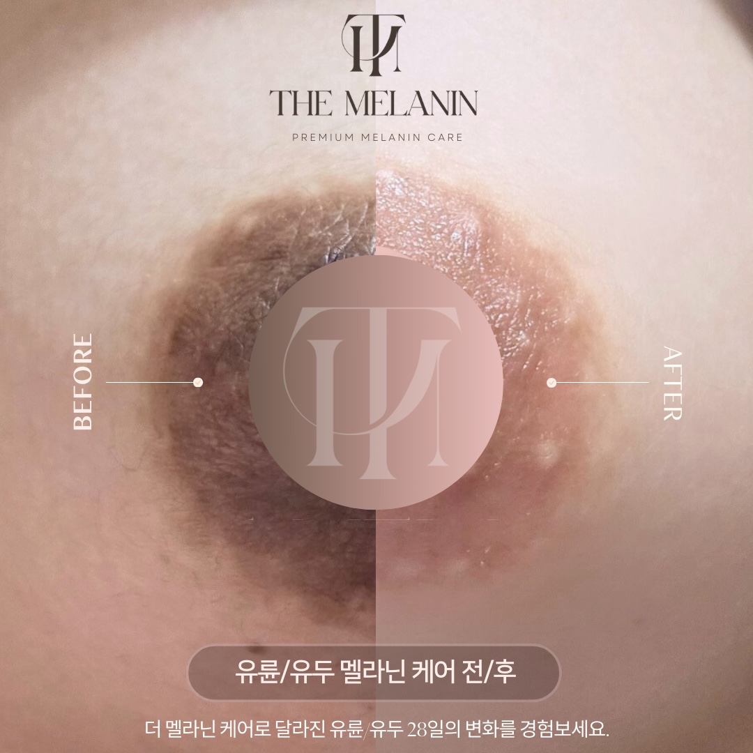 乳輪ケア Before After