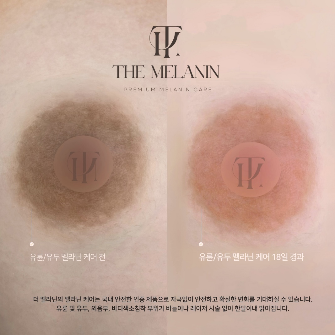 乳輪ケア Before After