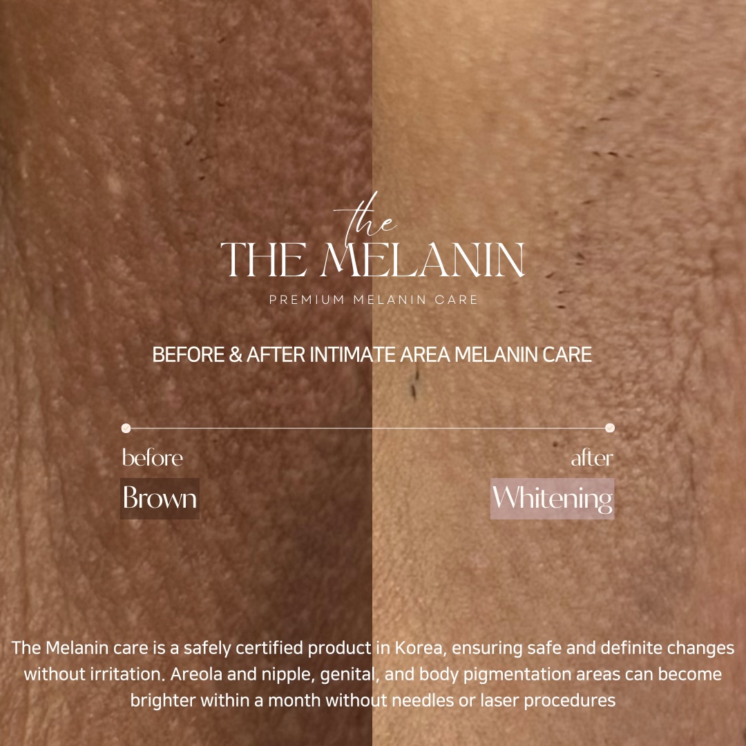 Iラインケア Before After