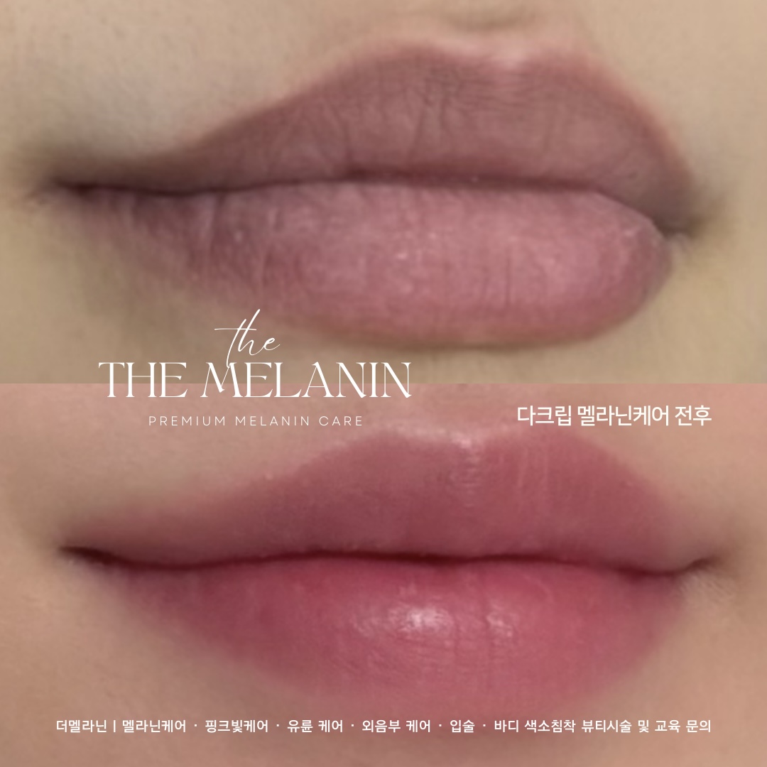 唇ケア Before After