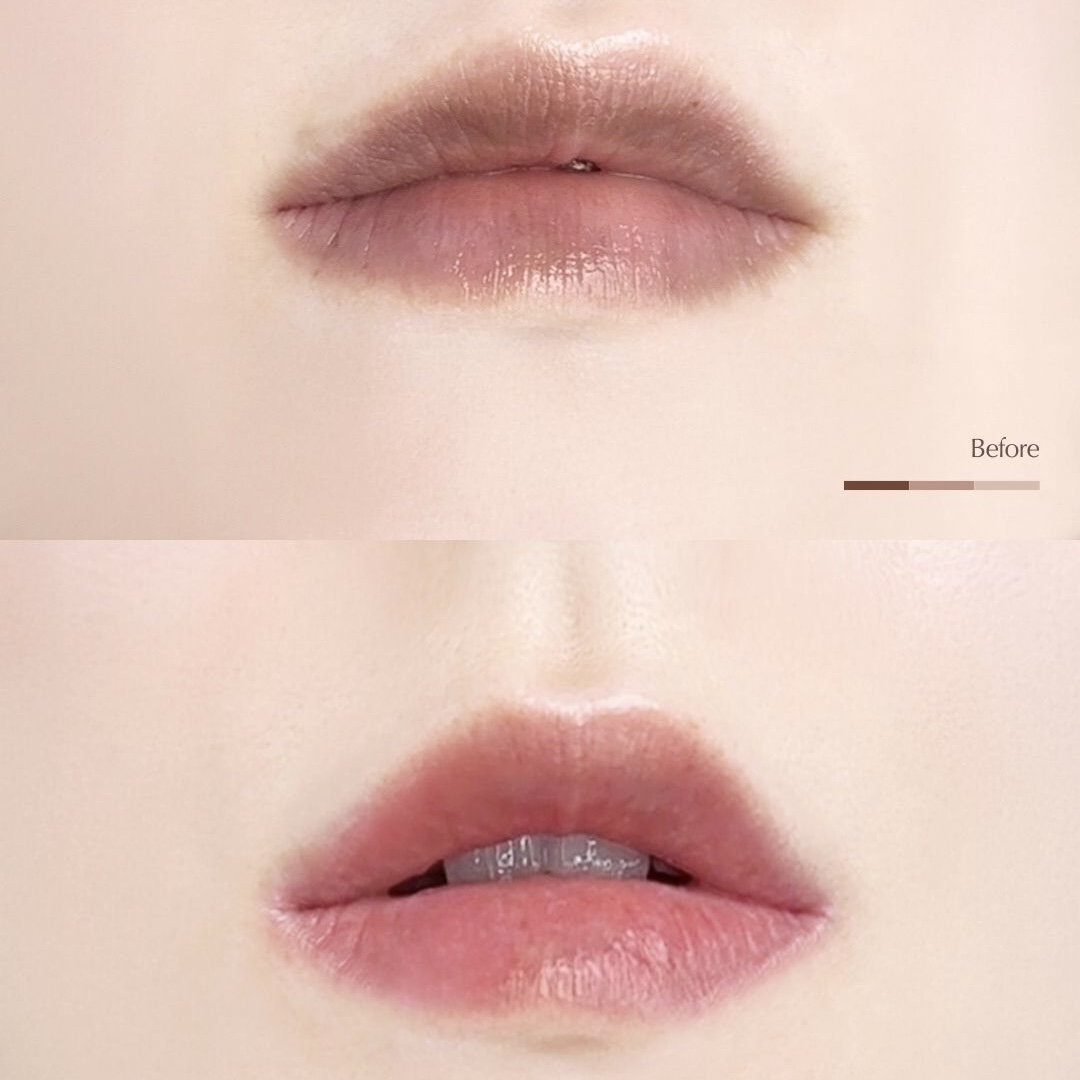 唇ケア Before After